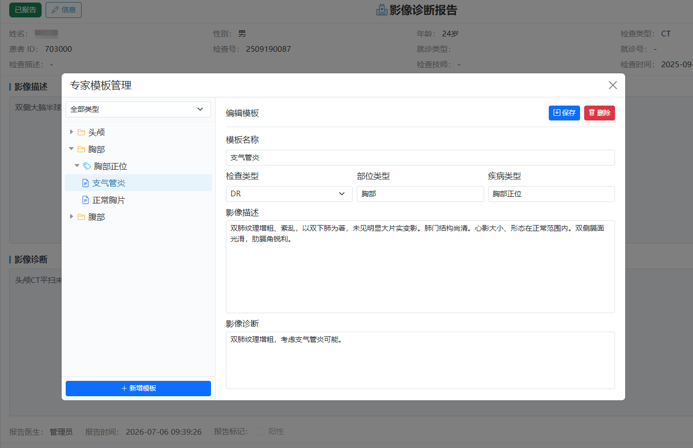 模版管理