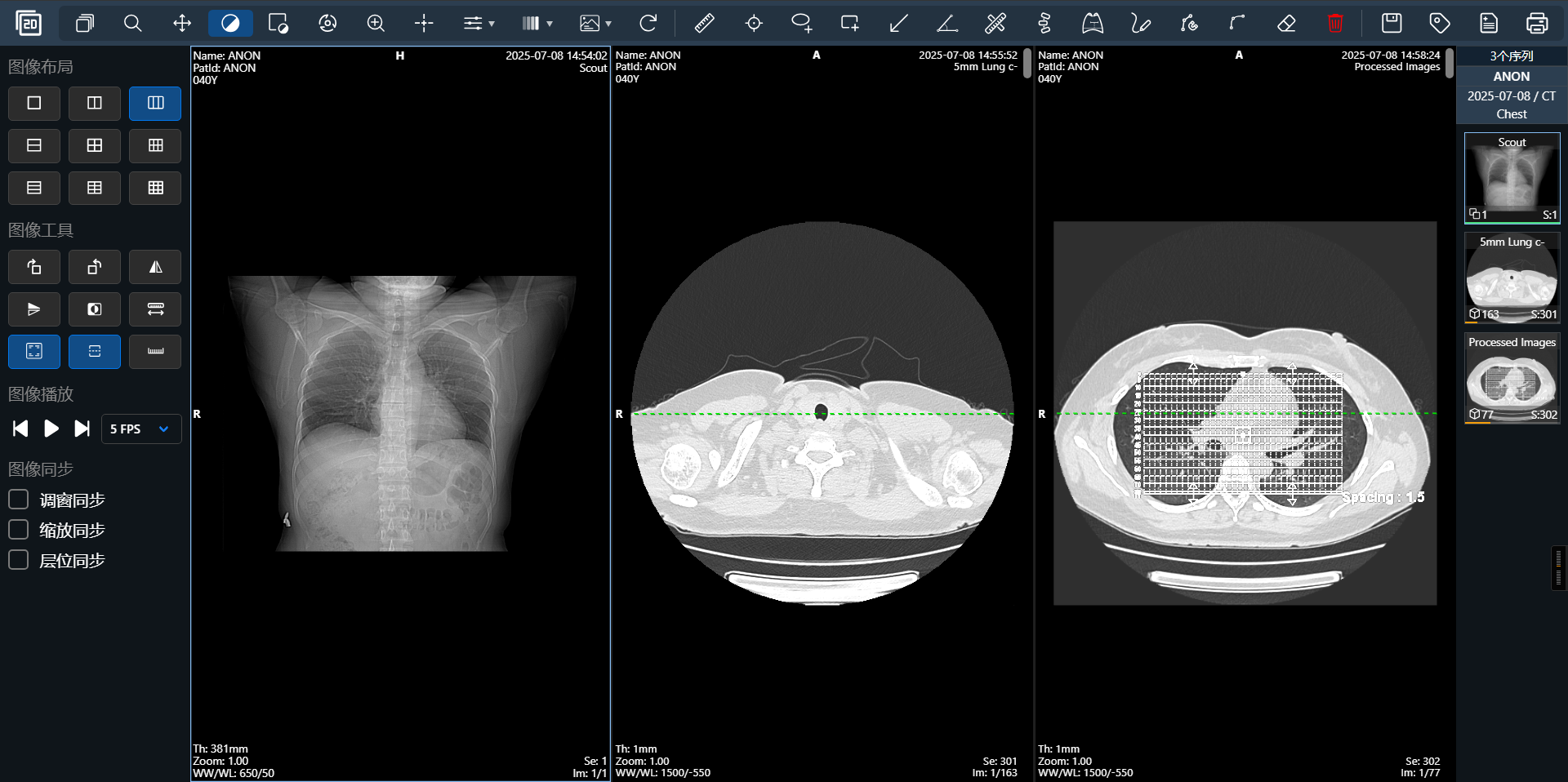 DcmViewer